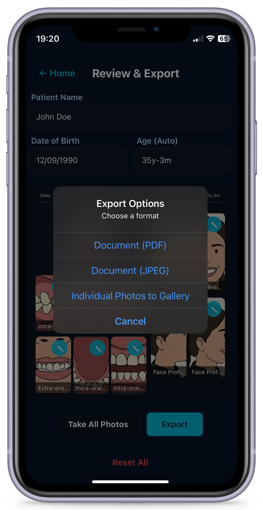 OrthoPhoto Review Screen